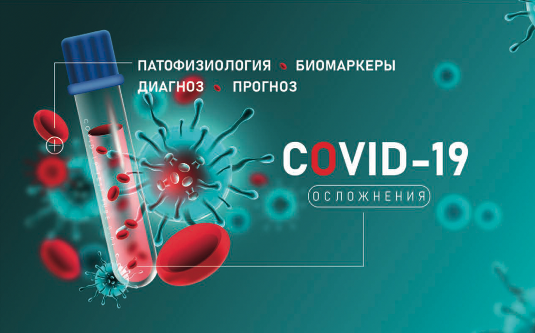 Новая брошюра «Осложнения COVID-19: патофизиология, биомаркеры, диагноз, прогноз» - новости ГК Диакон