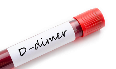Что нужно знать врачам о D-димере