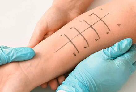 Квалификация или регион: кто формирует цену визита к аллергологу?